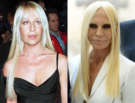 donatella versace pre surgery|donatella versace without make up.